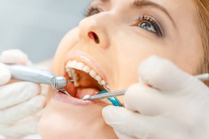 Why Regular Dental Checkups Matter: How Often Should You Visit?